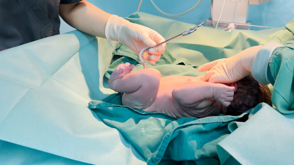 醫(yī)生為胎兒輸臍血。重慶安琪兒婦產(chǎn)醫(yī)院供圖