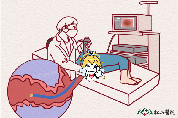 腸鏡檢查。重慶松山醫(yī)院供圖