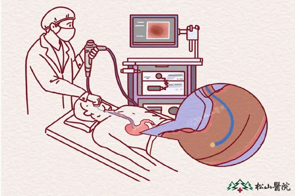 胃鏡檢查。重慶松山醫(yī)院供圖