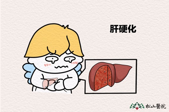 肝硬化。重慶松山醫(yī)院供圖