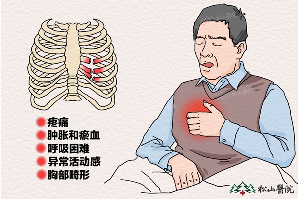 肋骨骨折癥狀。重慶松山醫(yī)院供圖