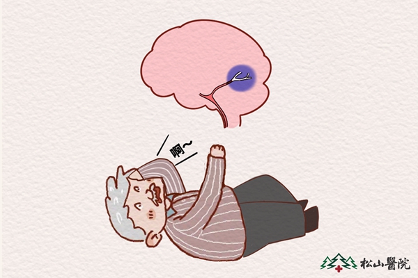 腦卒中。重慶松山醫(yī)院供圖