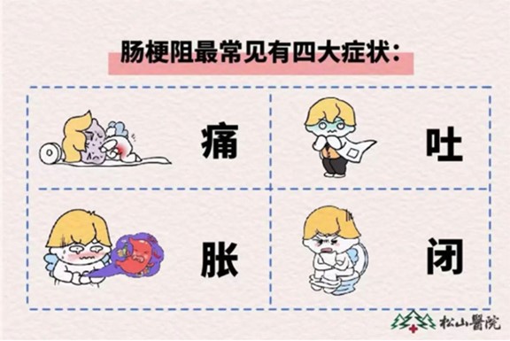 腸梗阻癥狀。重慶松山醫(yī)院供圖