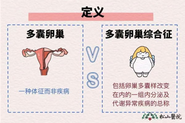 多囊與多囊卵巢綜合征的定義。重慶松山醫(yī)院供圖