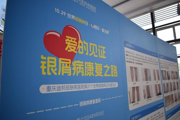 活動現(xiàn)場。重慶迪邦皮膚病醫(yī)院供圖
