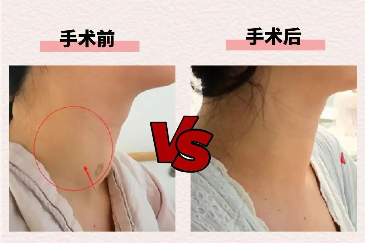 術(shù)后情況。重慶松山醫(yī)院供圖