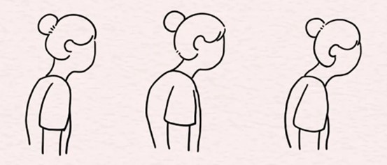 示意圖。重慶松山醫(yī)院供圖