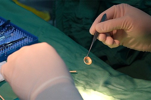 手術現場。重慶普瑞眼科醫(yī)院供圖