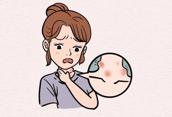 示意圖。重慶松山醫(yī)院供圖