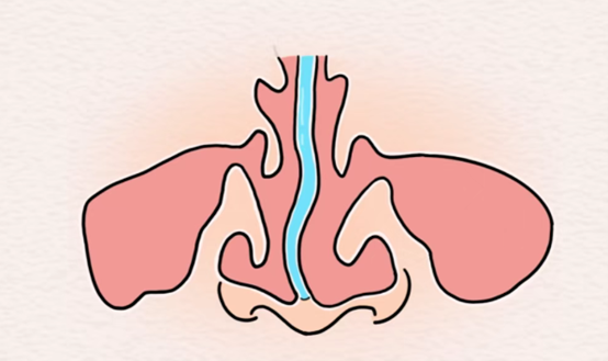示意圖。重慶松山醫(yī)院供圖