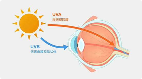 紫外線對(duì)眼睛的傷害。重慶南坪愛(ài)爾眼科醫(yī)院供圖