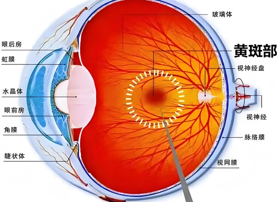 黃斑部。重慶普瑞眼科醫(yī)院供圖